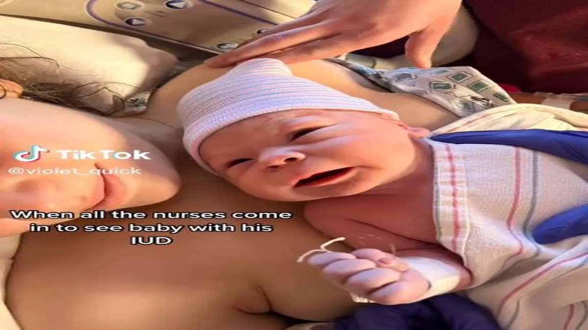 Bebê Nasce Segurando DIU Que Mãe Utilizava Para Evitar Gravidez E Vídeo Viraliza