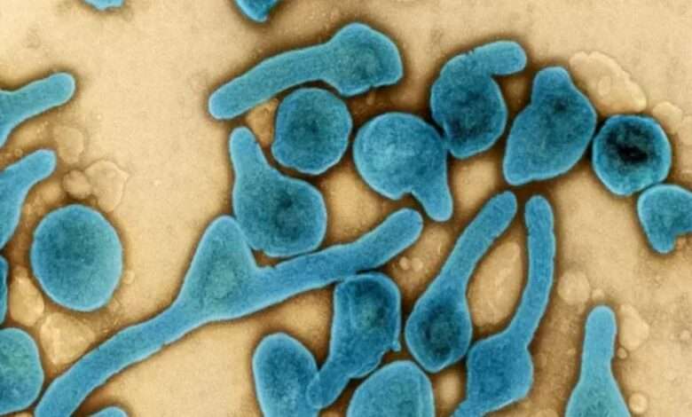 Vírus é Da Mesma Família Do Ebola